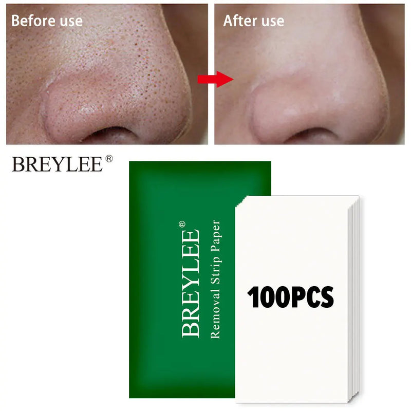 Papel Breylee Removedor de Máscara Facial Para Passo Removedor de Cravos  100 pçs