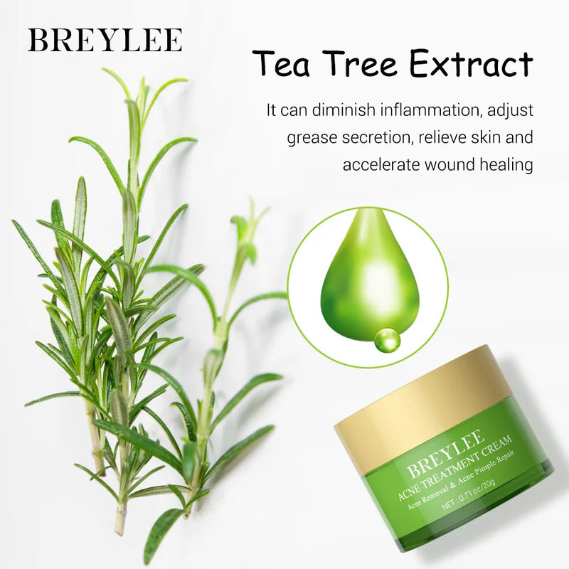 Creme de Tratamento para Acne Tea Tree -Melaleuca- BREYLEE 20g  Remoção de Manchas , Controle Oleosidade ,Encolher Poros ,Hidratante